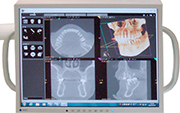 デジタル画像診断システム